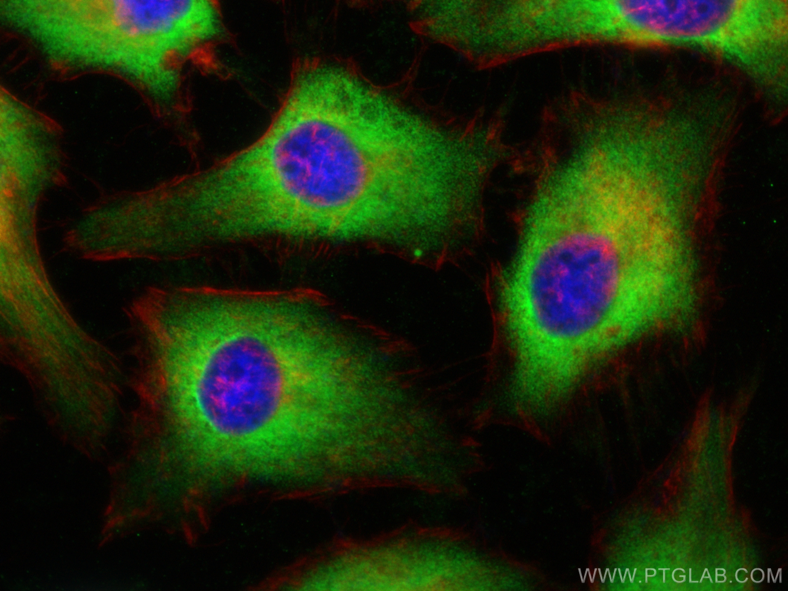 IF Staining of HeLa using 60085-1-Ig