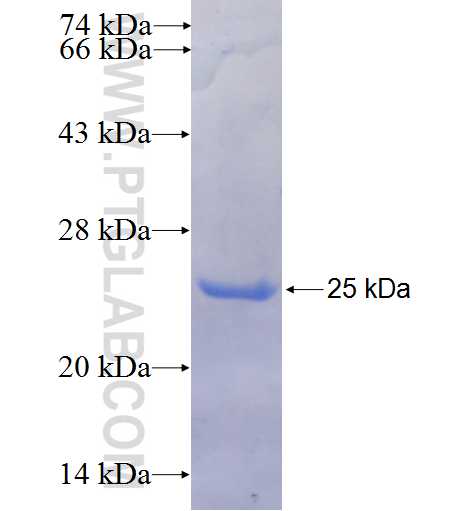 EEF1E1 fusion protein Ag25350 SDS-PAGE