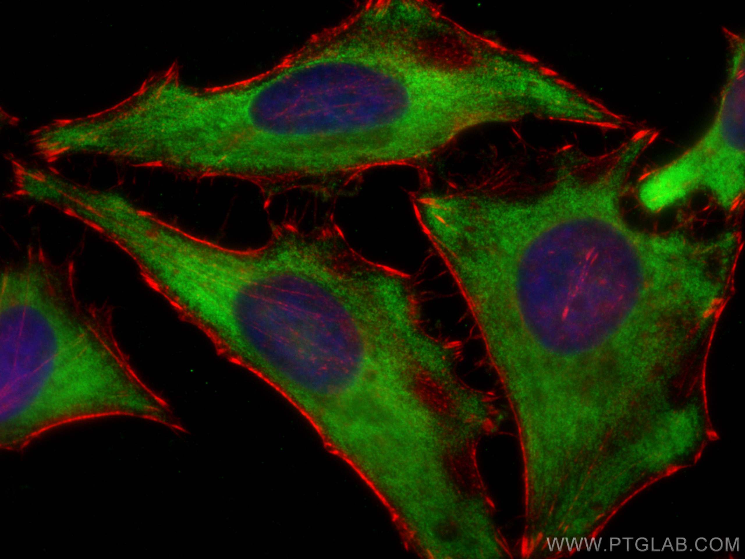 IF Staining of HeLa using 68148-1-Ig