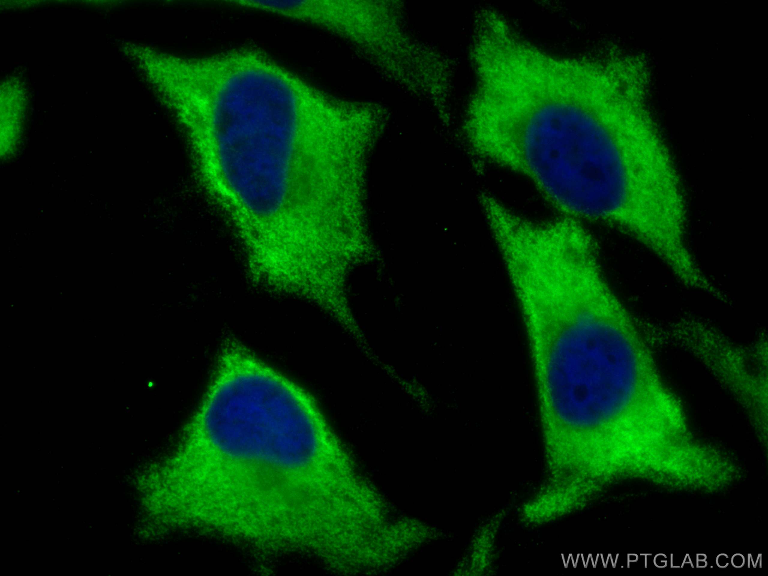 IF Staining of HeLa using 68148-1-Ig (same clone as 68148-1-PBS)