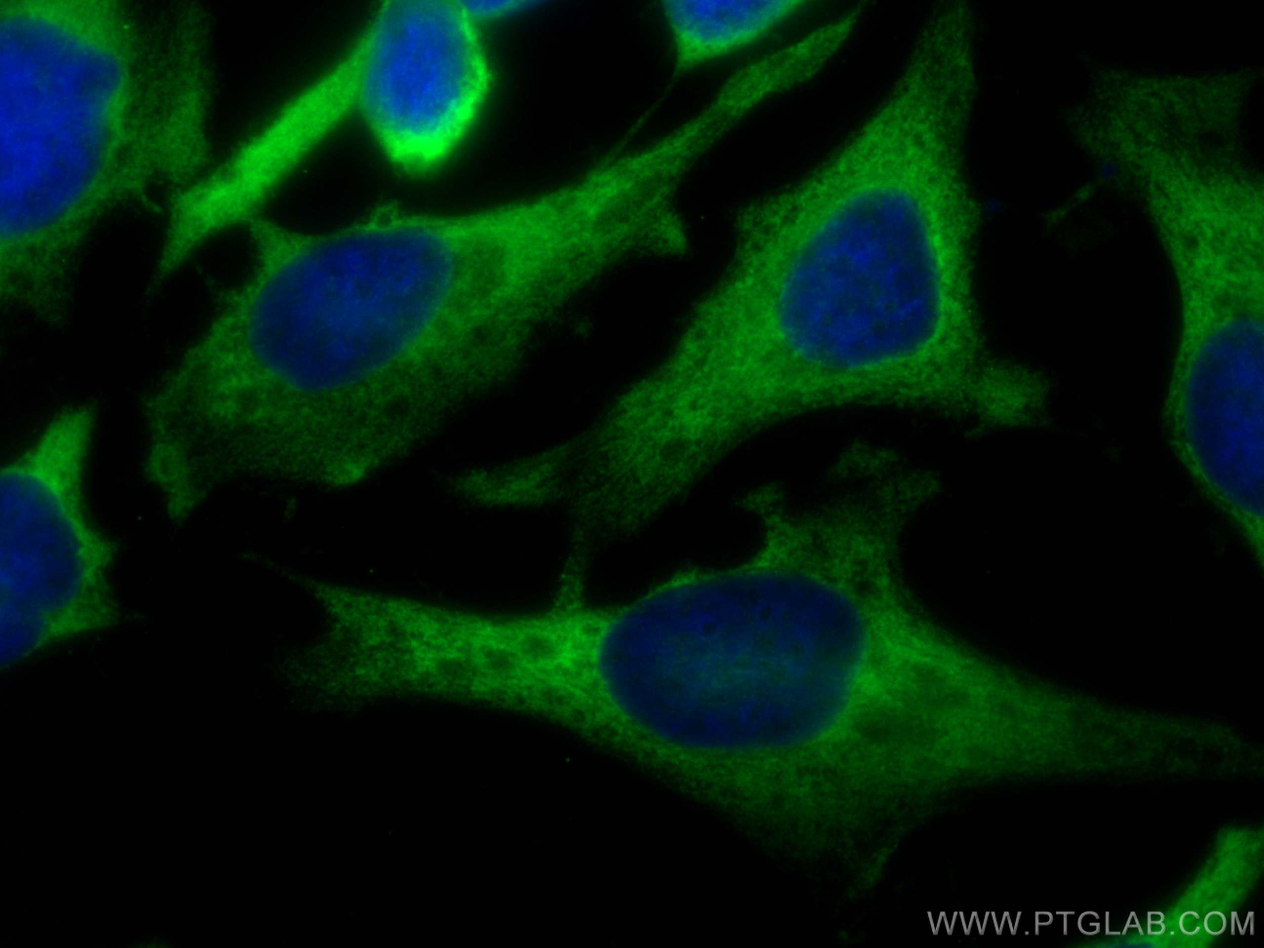 IF Staining of HeLa using CL488-68148