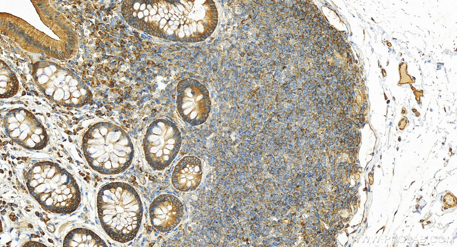 IHC staining of human colon using 20107-1-AP (same clone as 20107-1-PBS)