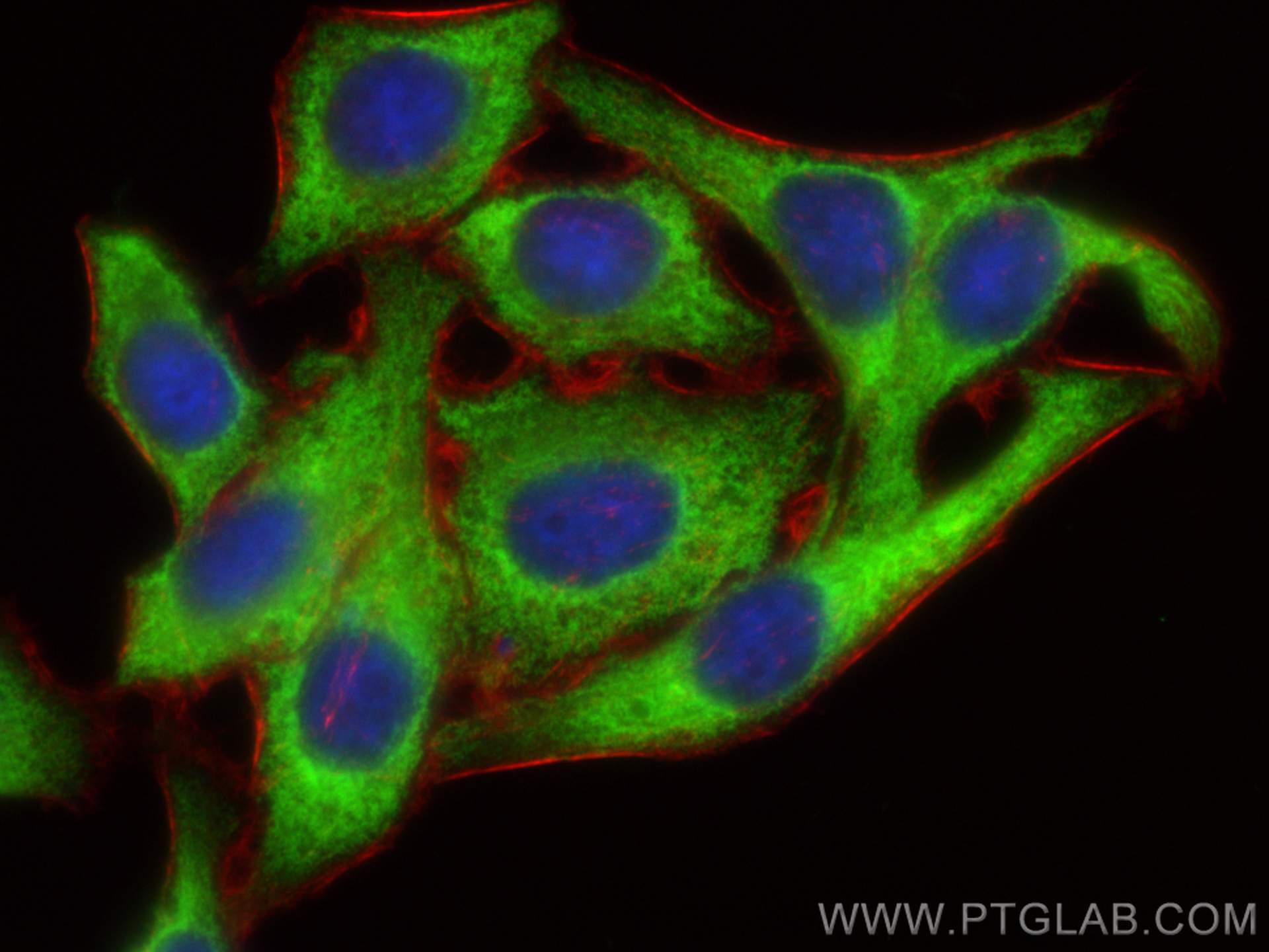 IF Staining of HepG2 using 20107-1-AP (same clone as 20107-1-PBS)