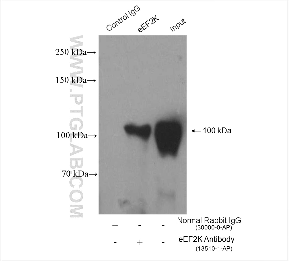 IP experiment of PC-3 using 13510-1-AP