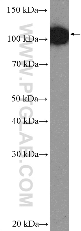 WB analysis of PC-3 using 13510-1-AP