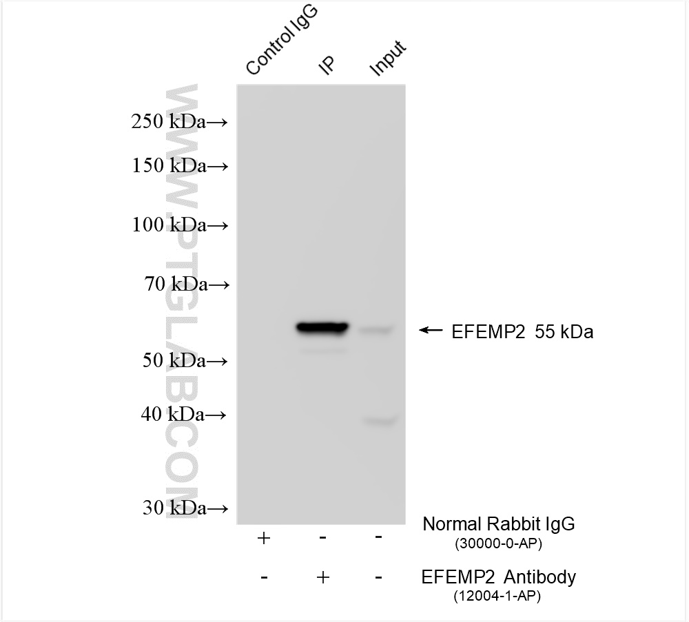 IP experiment of mouse kidney using 12004-1-AP