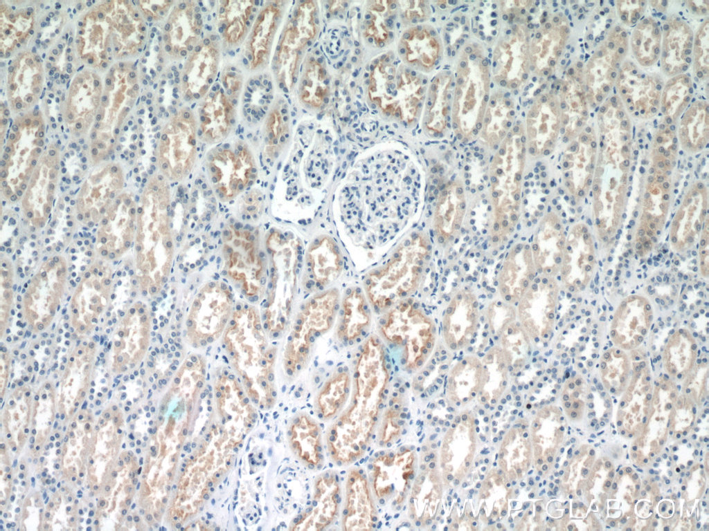 IHC staining of human kidney using 19854-1-AP