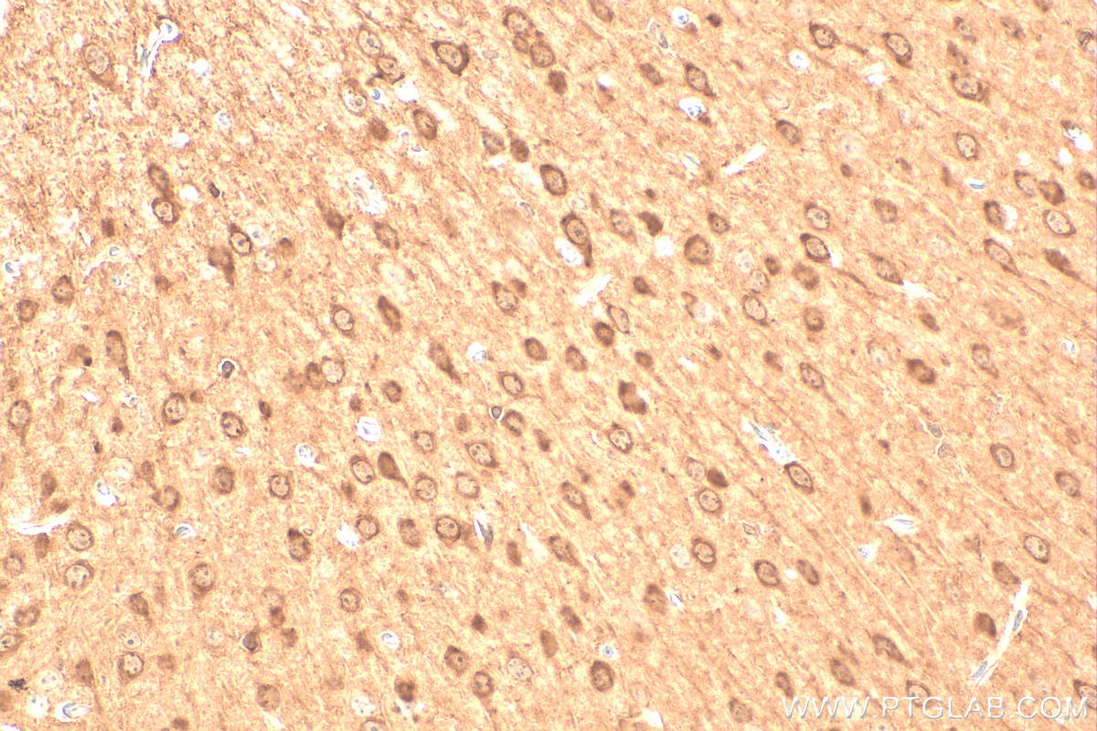 IHC staining of mouse brain using 31624-1-AP