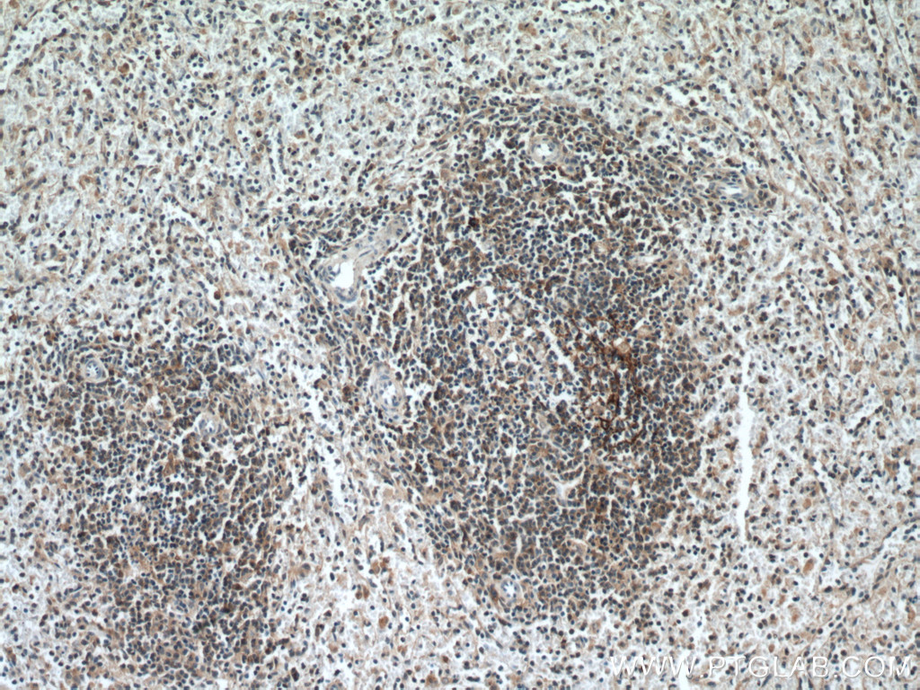 IHC staining of human spleen using 20538-1-AP