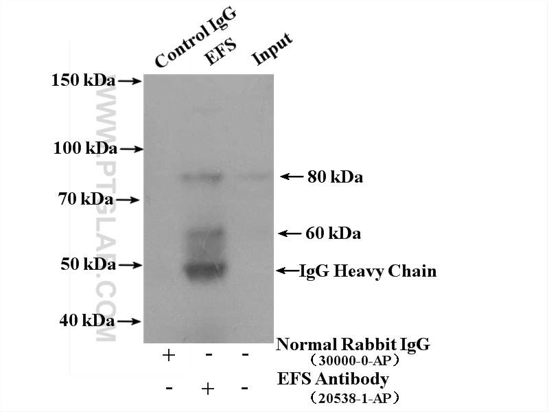 IP experiment of mouse thymus using 20538-1-AP