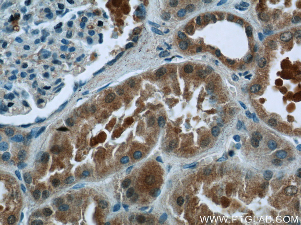 IHC staining of human kidney using 24729-1-AP