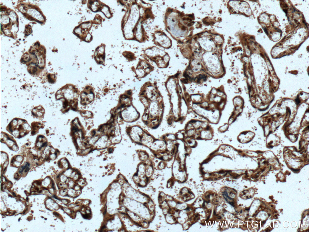 IHC staining of human placenta using 26661-1-AP