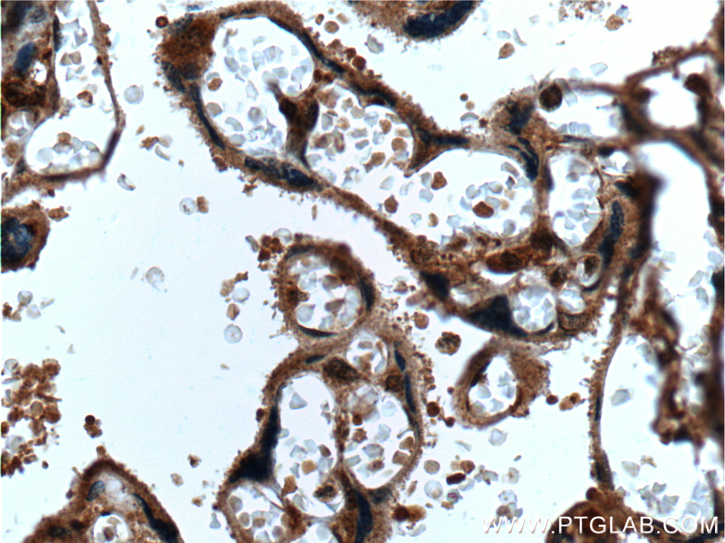 IHC staining of human placenta using 26661-1-AP