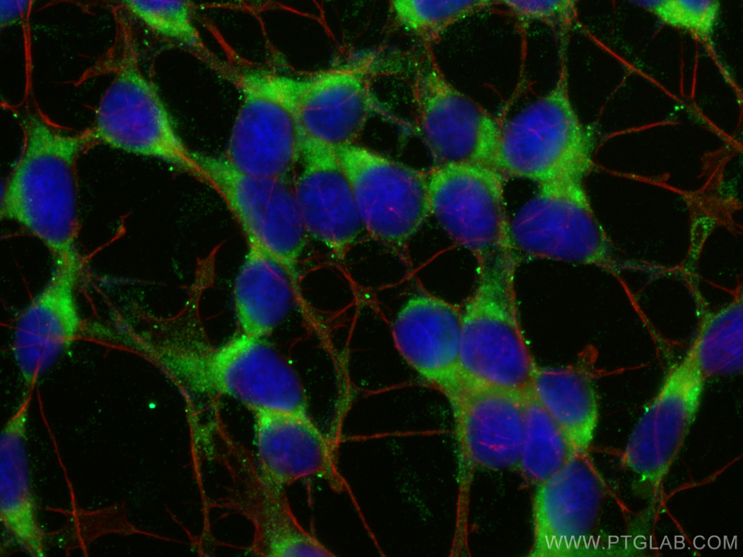 IF Staining of SH-SY5Y using 14578-1-AP