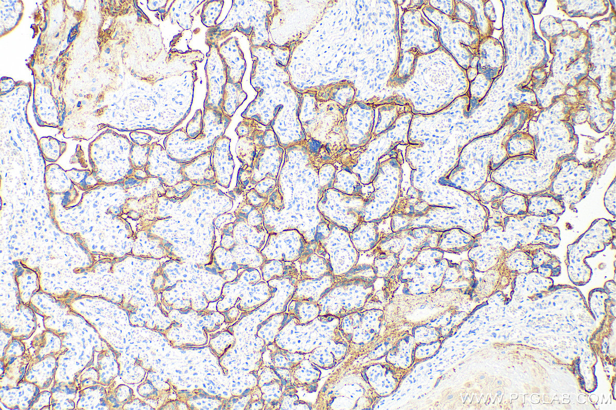 IHC staining of human placenta using 66455-1-Ig