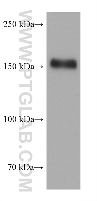 WB analysis of SCaBER using 68643-1-Ig (same clone as 68643-1-PBS)