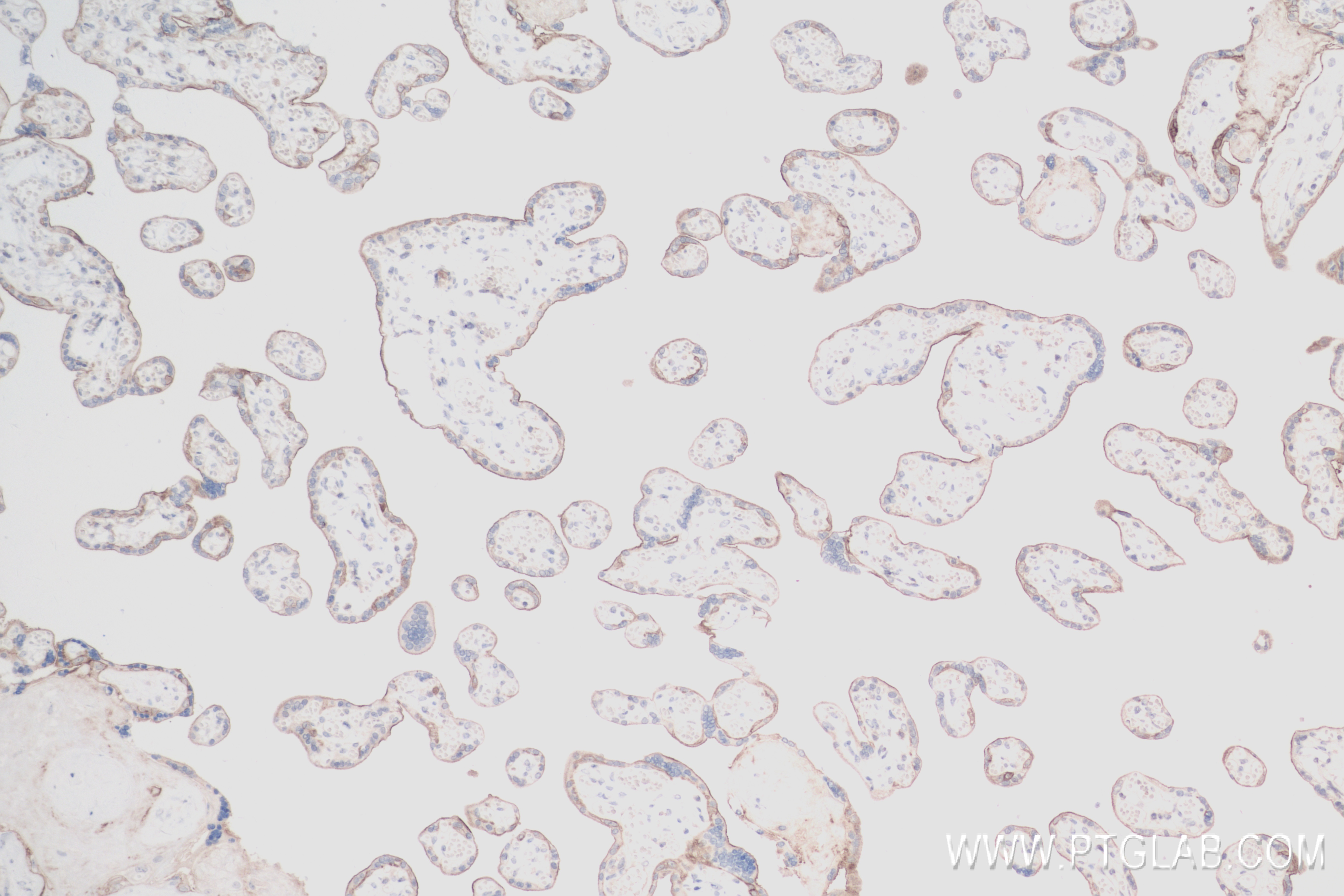 IHC staining of human placenta using 83806-1-RR (same clone as 83806-1-PBS)