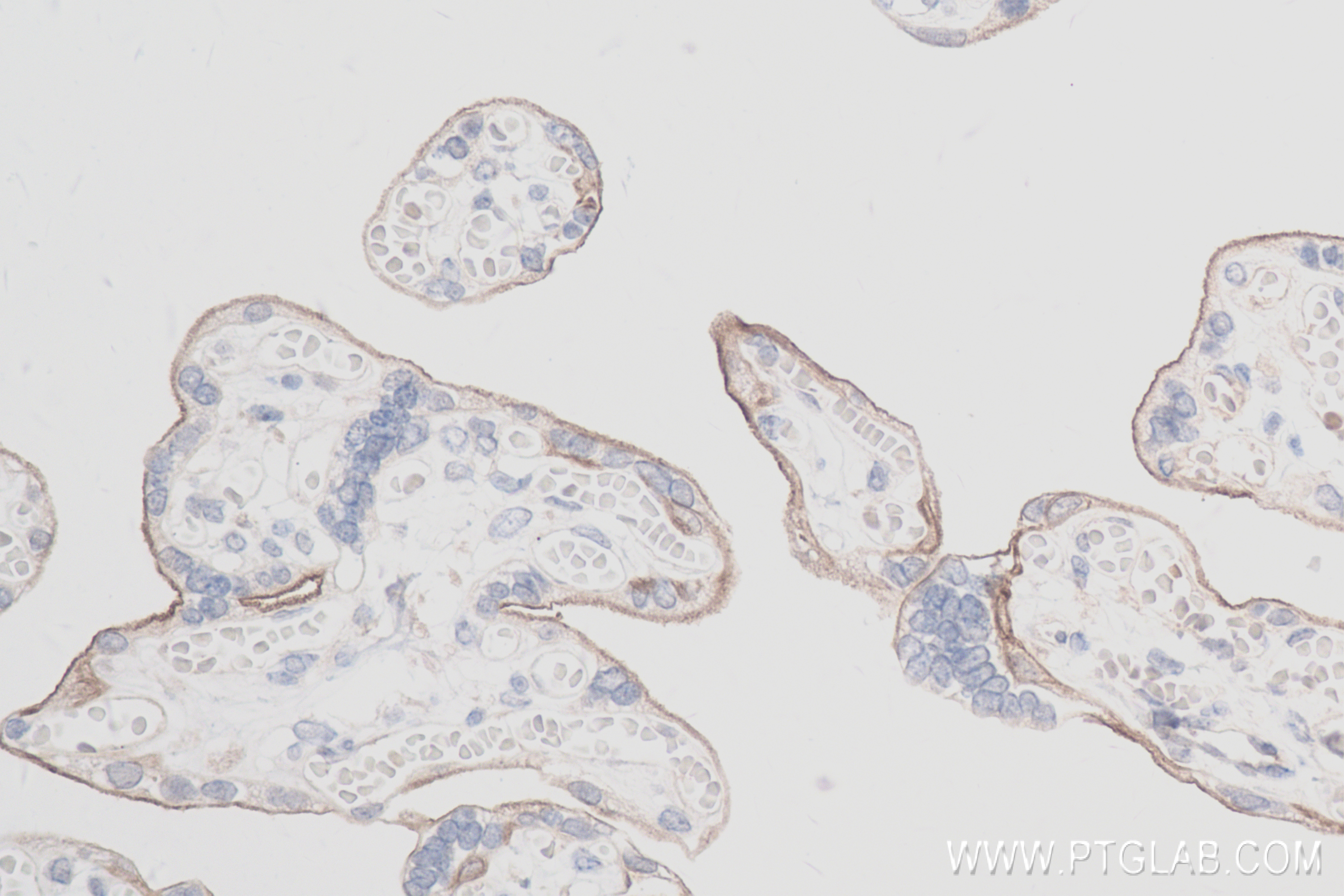 IHC staining of human placenta using 83806-1-RR