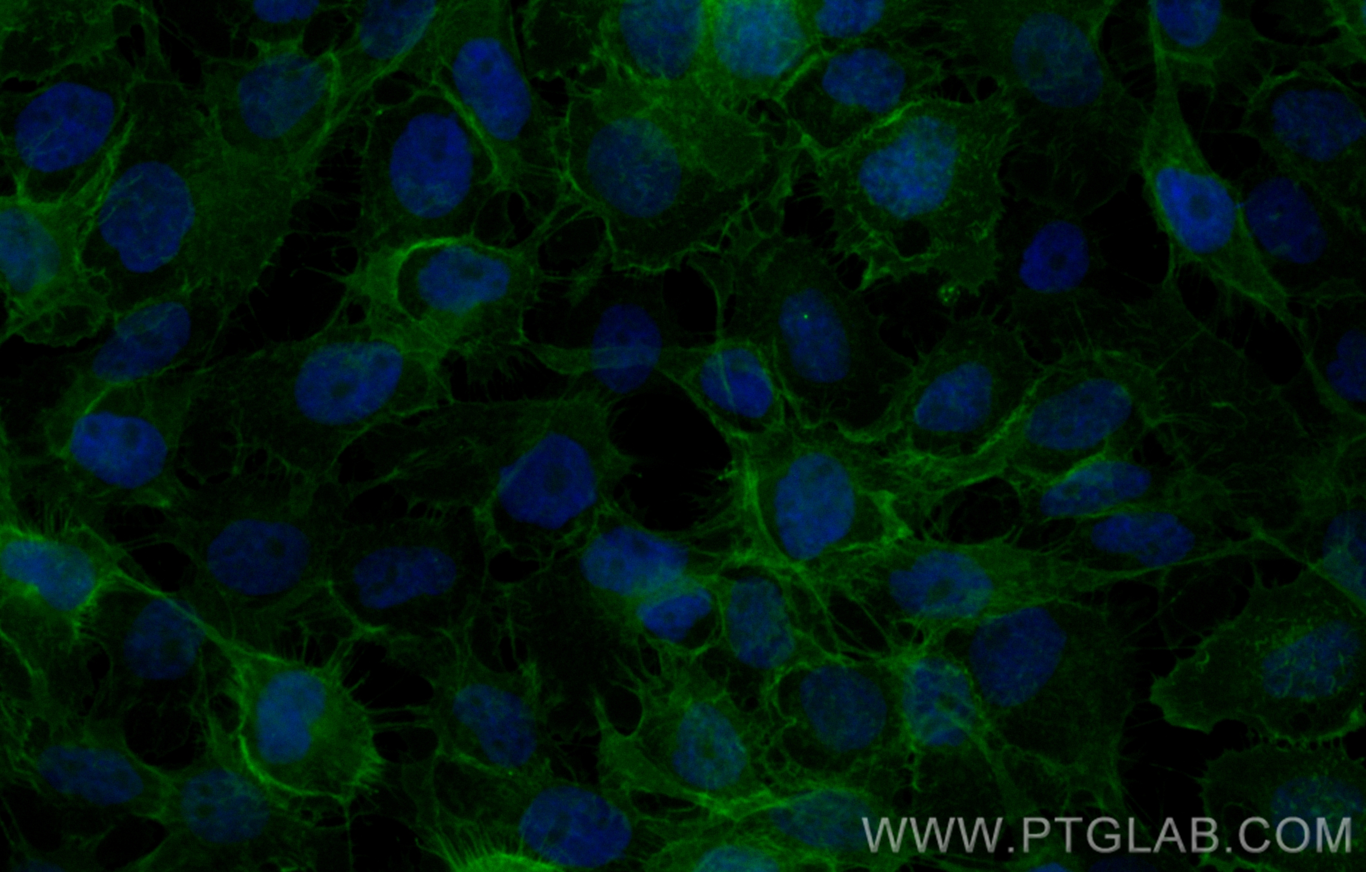 IF Staining of A431 using CL488-83806