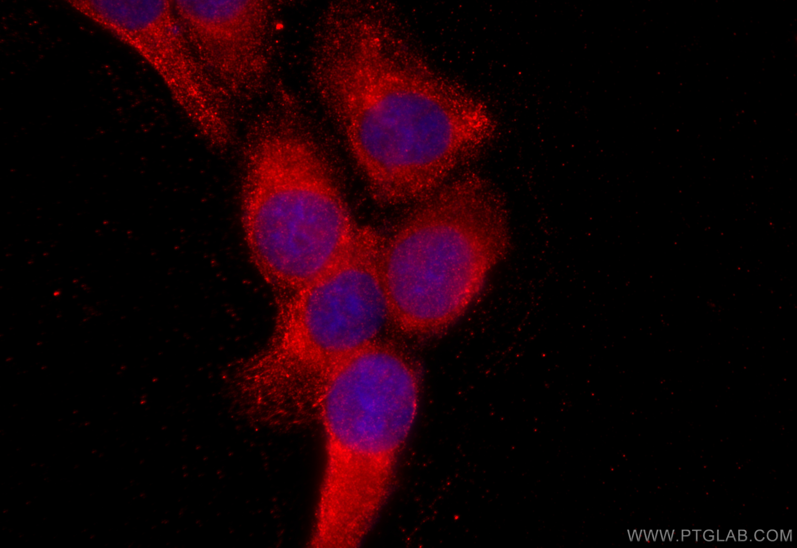 IF Staining of A431 using 19886-1-AP