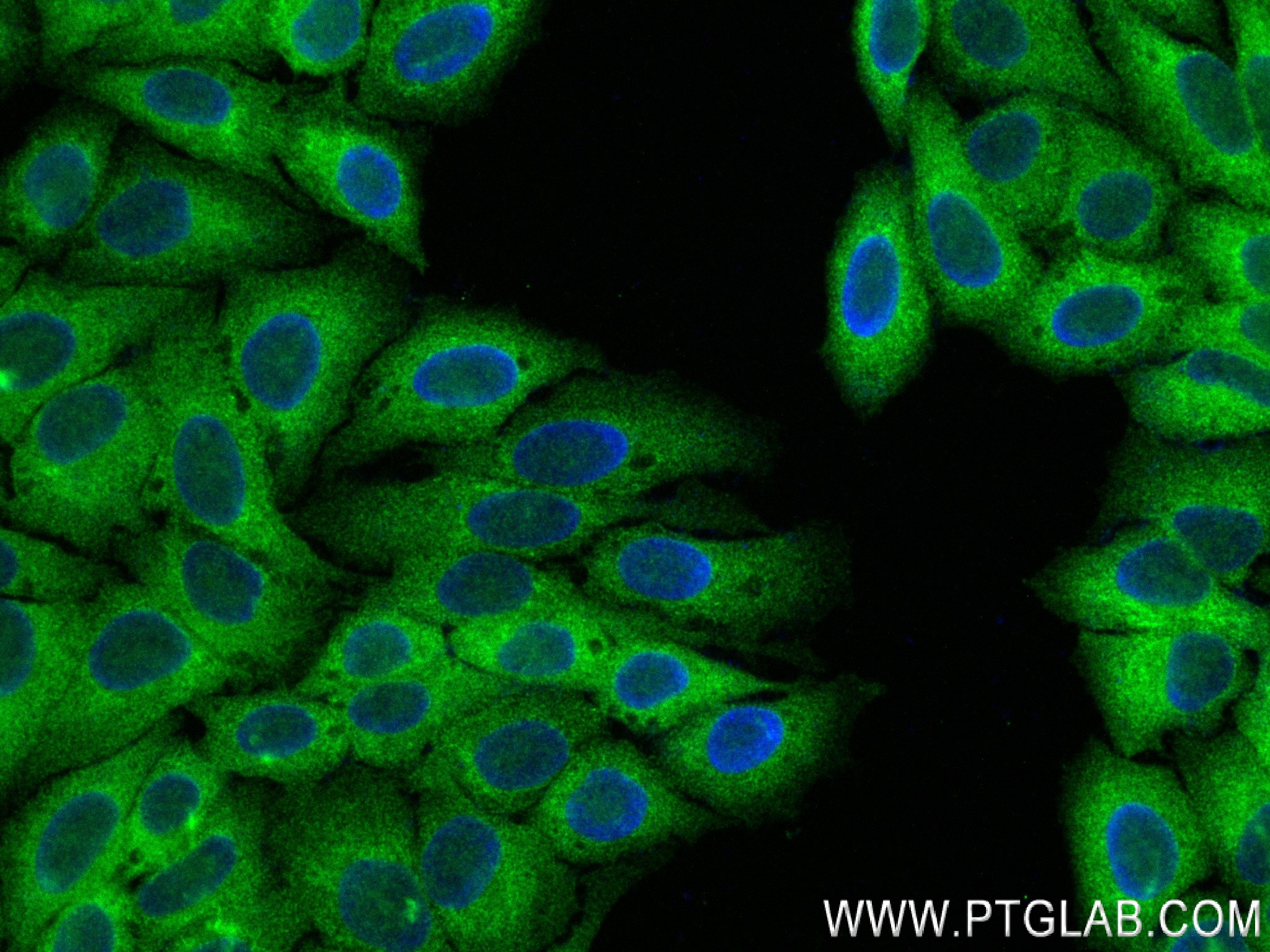 IF Staining of HepG2 using 83321-1-RR (same clone as 83321-1-PBS)