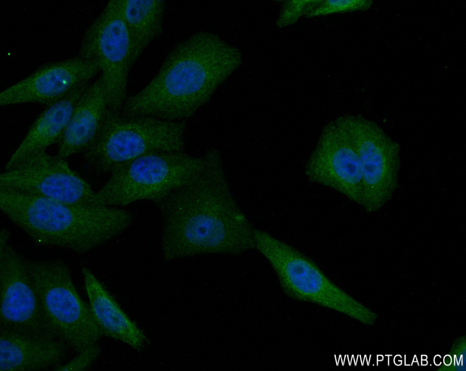 IF Staining of HepG2 using 82377-1-RR (same clone as 82377-1-PBS)