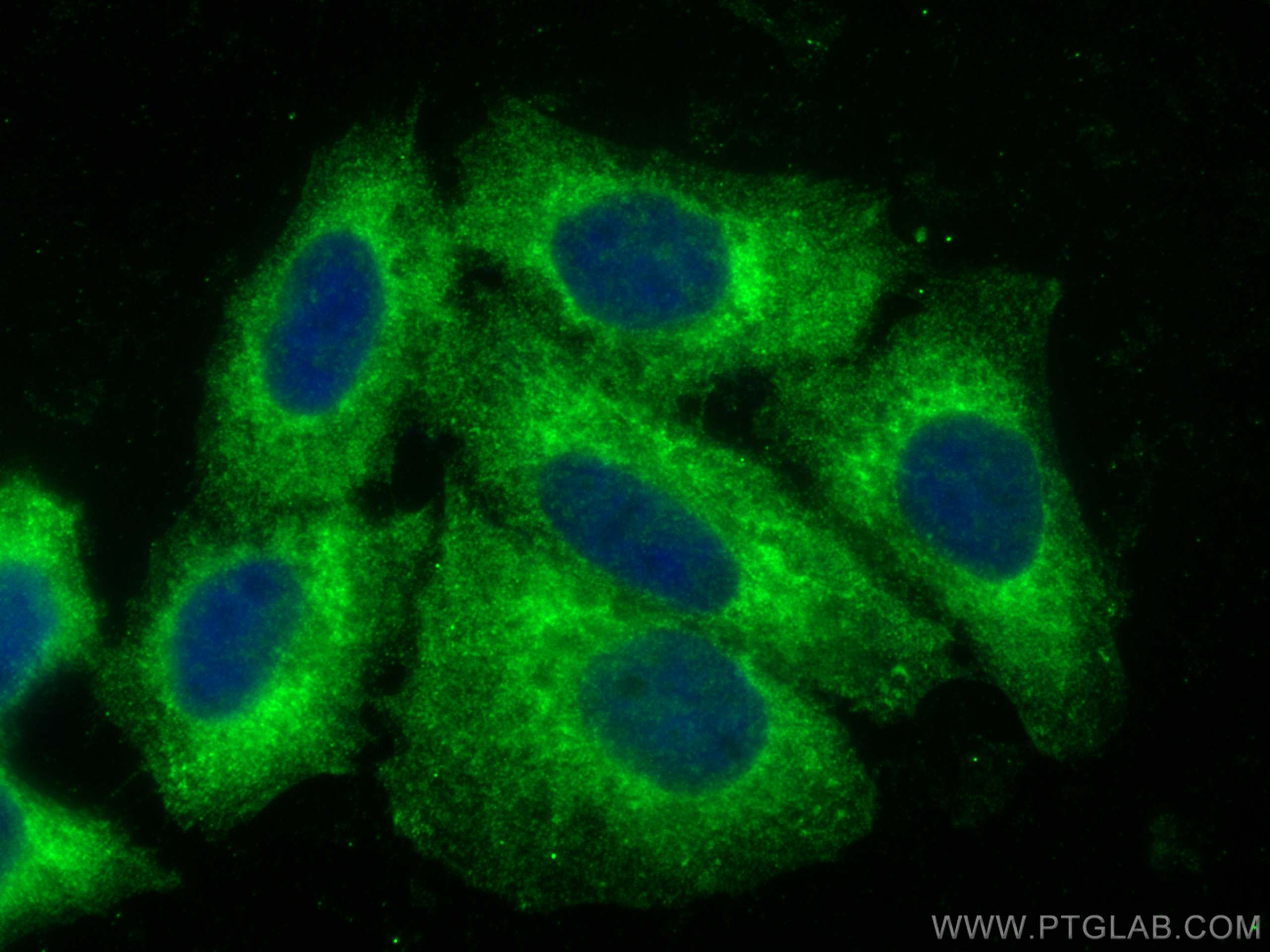 IF Staining of HepG2 using 17637-1-AP