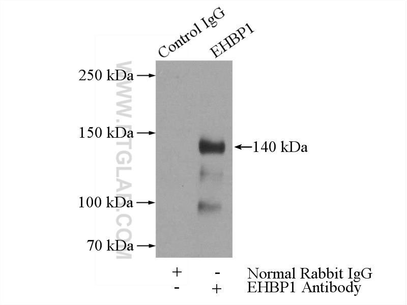 IP experiment of mouse liver using 17637-1-AP