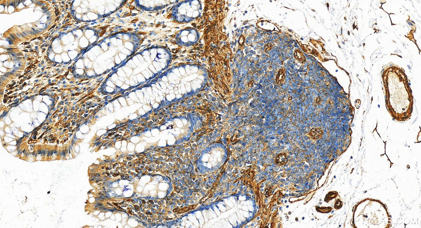 IHC staining of human normal colon using 11440-1-AP