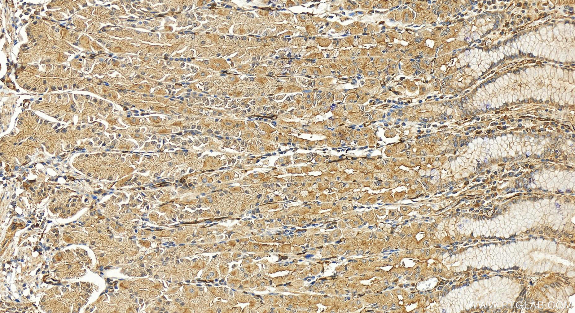 IHC staining of human stomach using 11382-2-AP