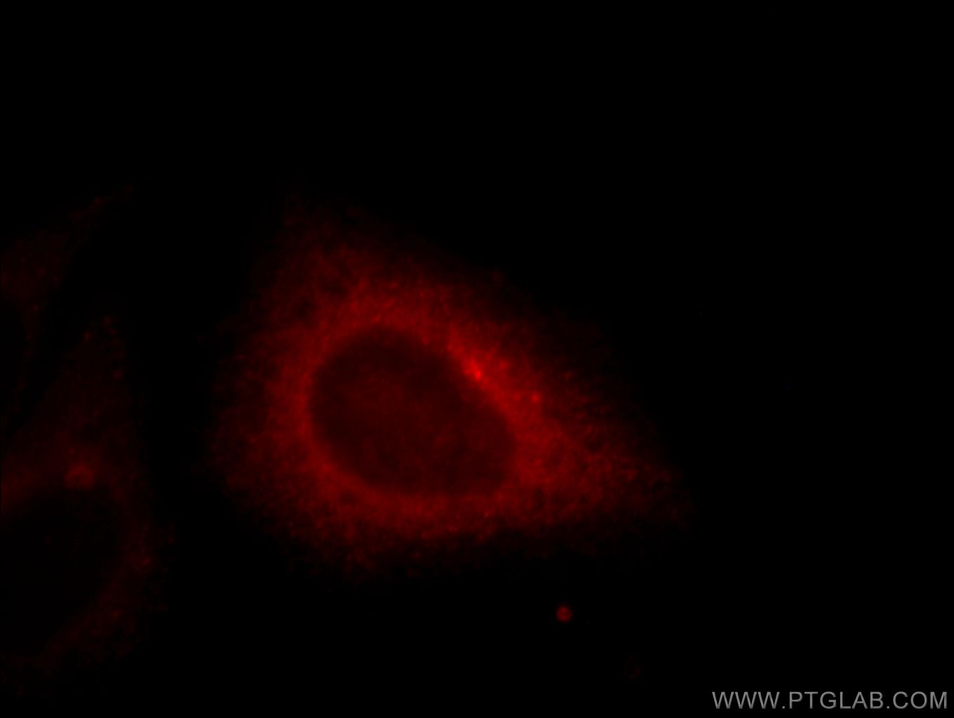 IF Staining of HepG2 using 11382-2-AP