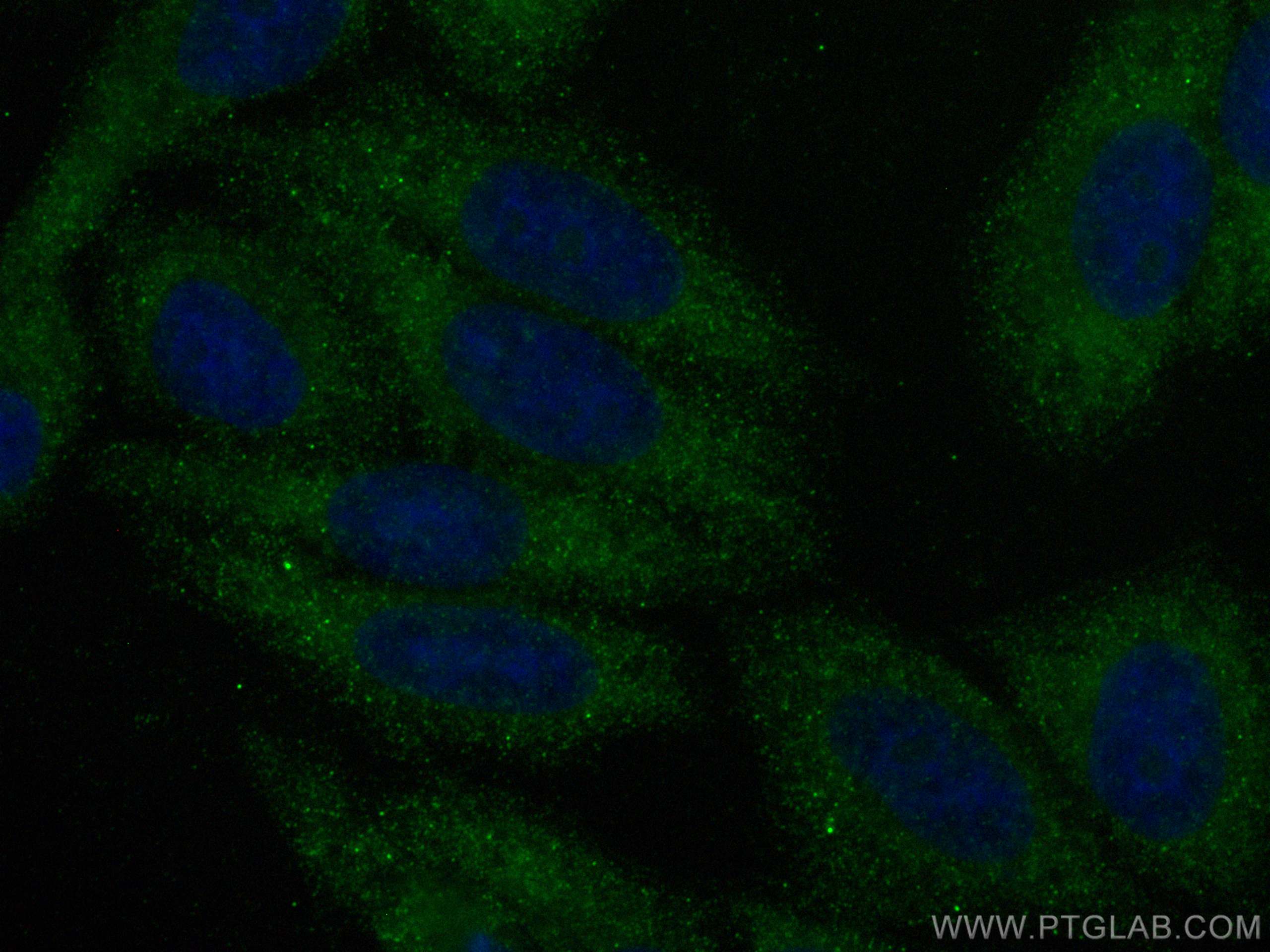 IF Staining of HepG2 using 14654-1-AP