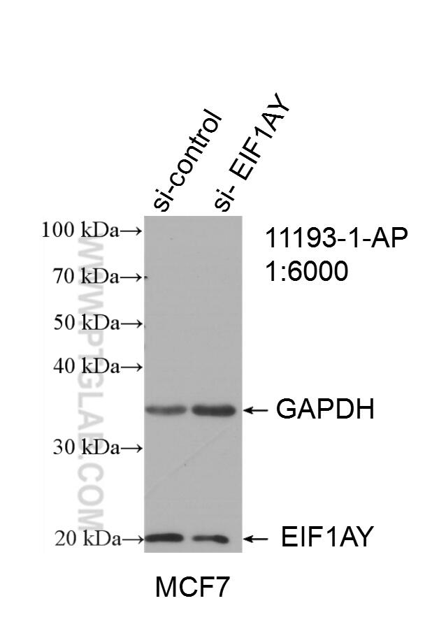 WB analysis of MCF-7 using 11193-1-AP