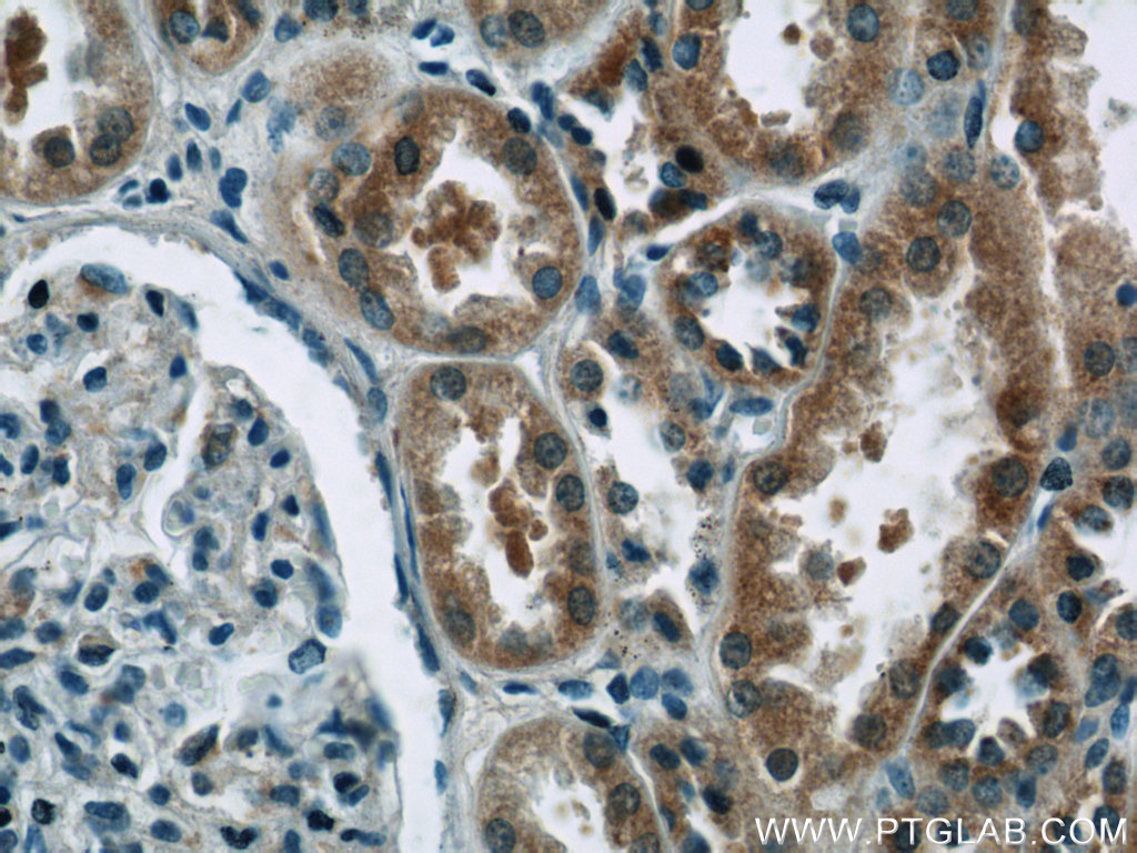 IHC staining of human kidney using 15887-1-AP