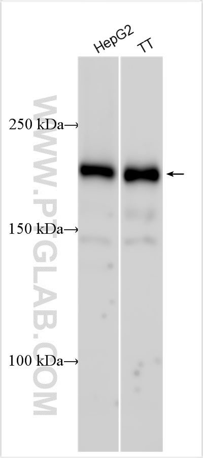 WB analysis using 27944-1-AP