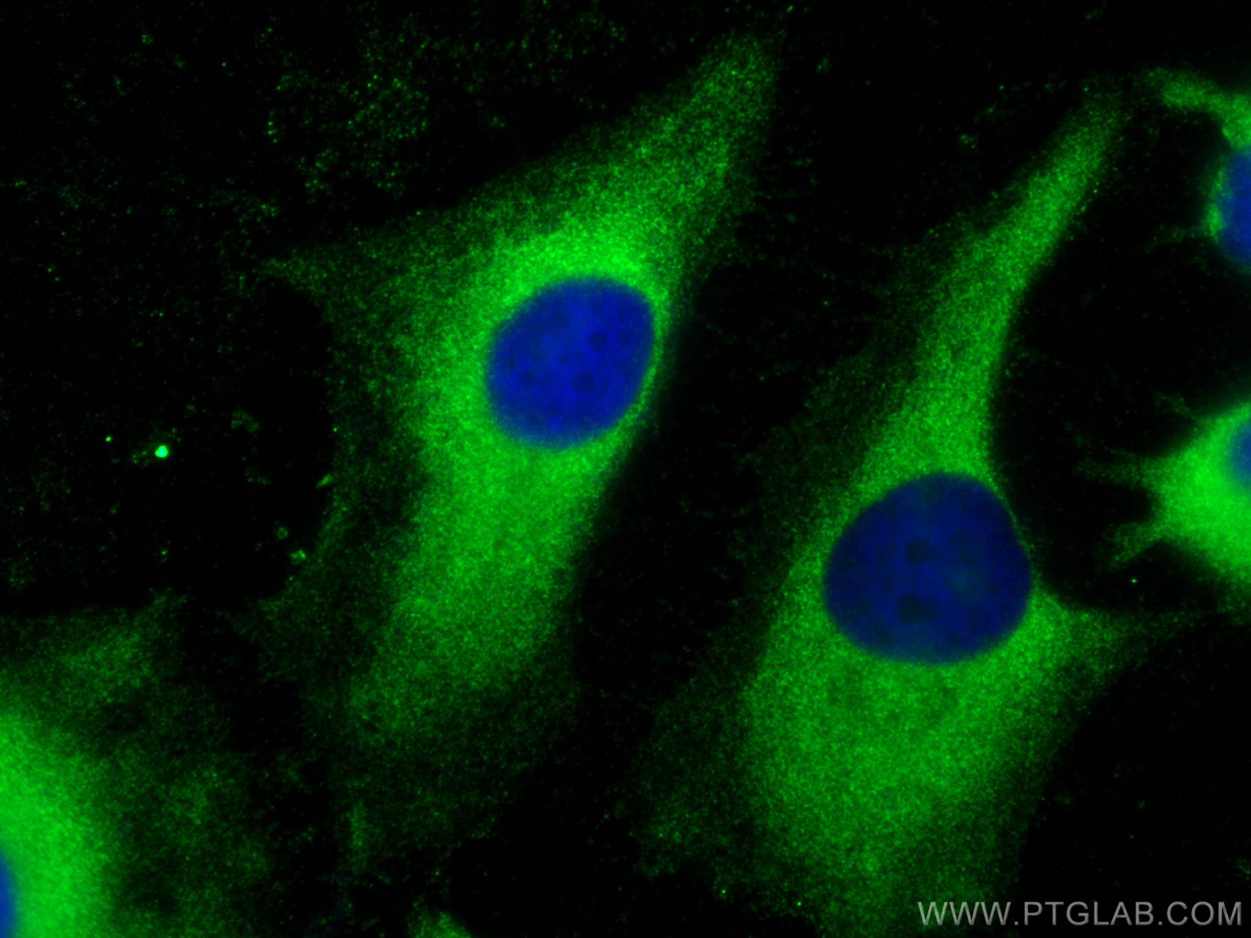 IF Staining of HeLa using 18010-1-AP