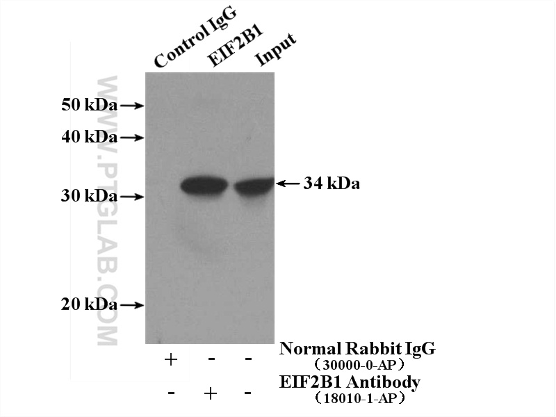 IP experiment of K-562 using 18010-1-AP