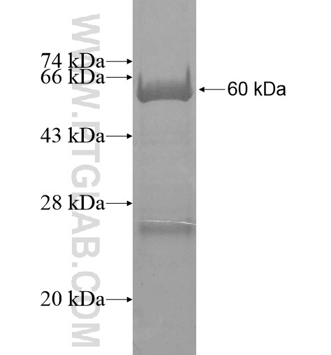 EIF2B1 fusion protein Ag12509 SDS-PAGE