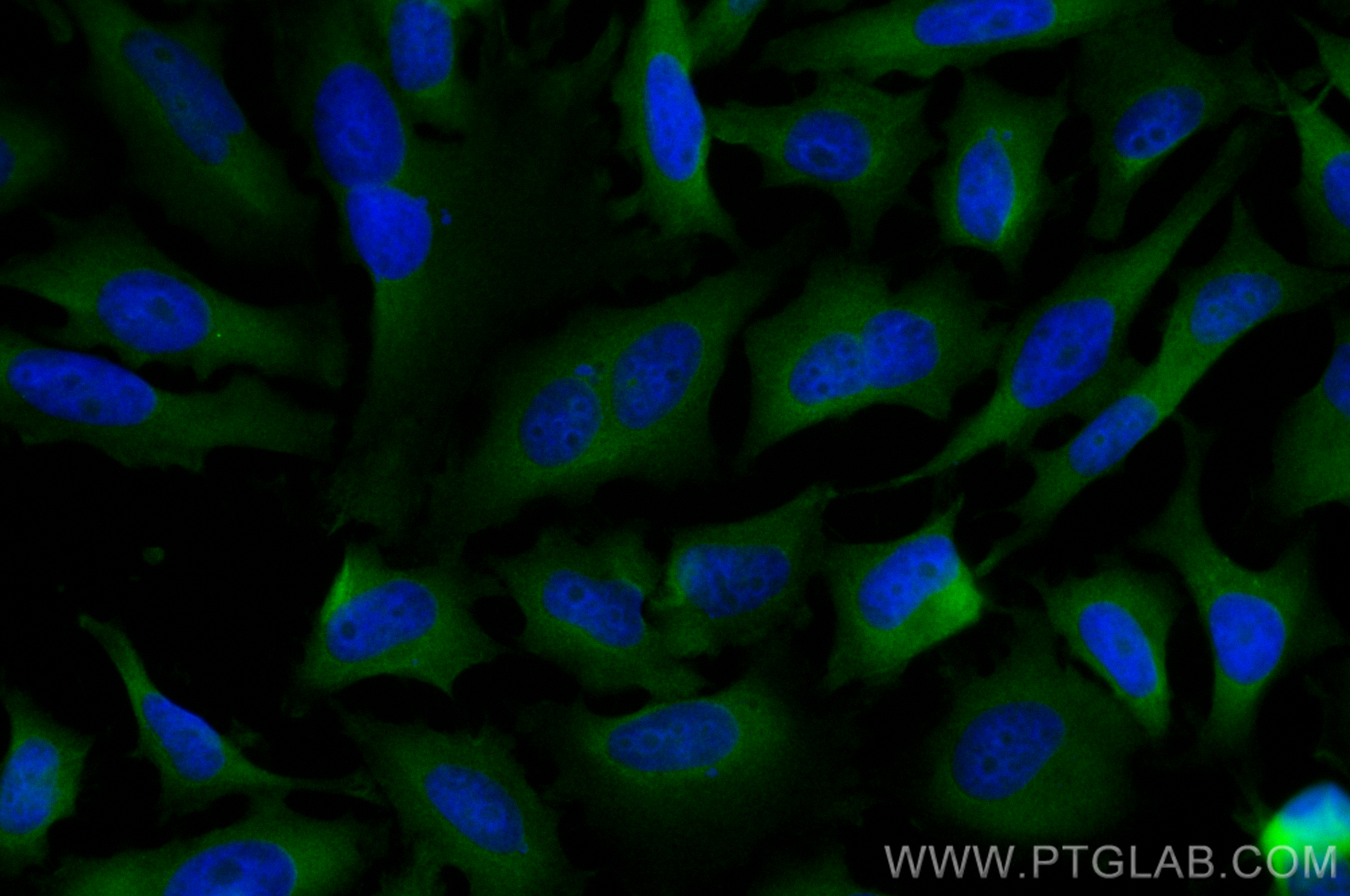 IF Staining of HeLa using CL488-82936-8