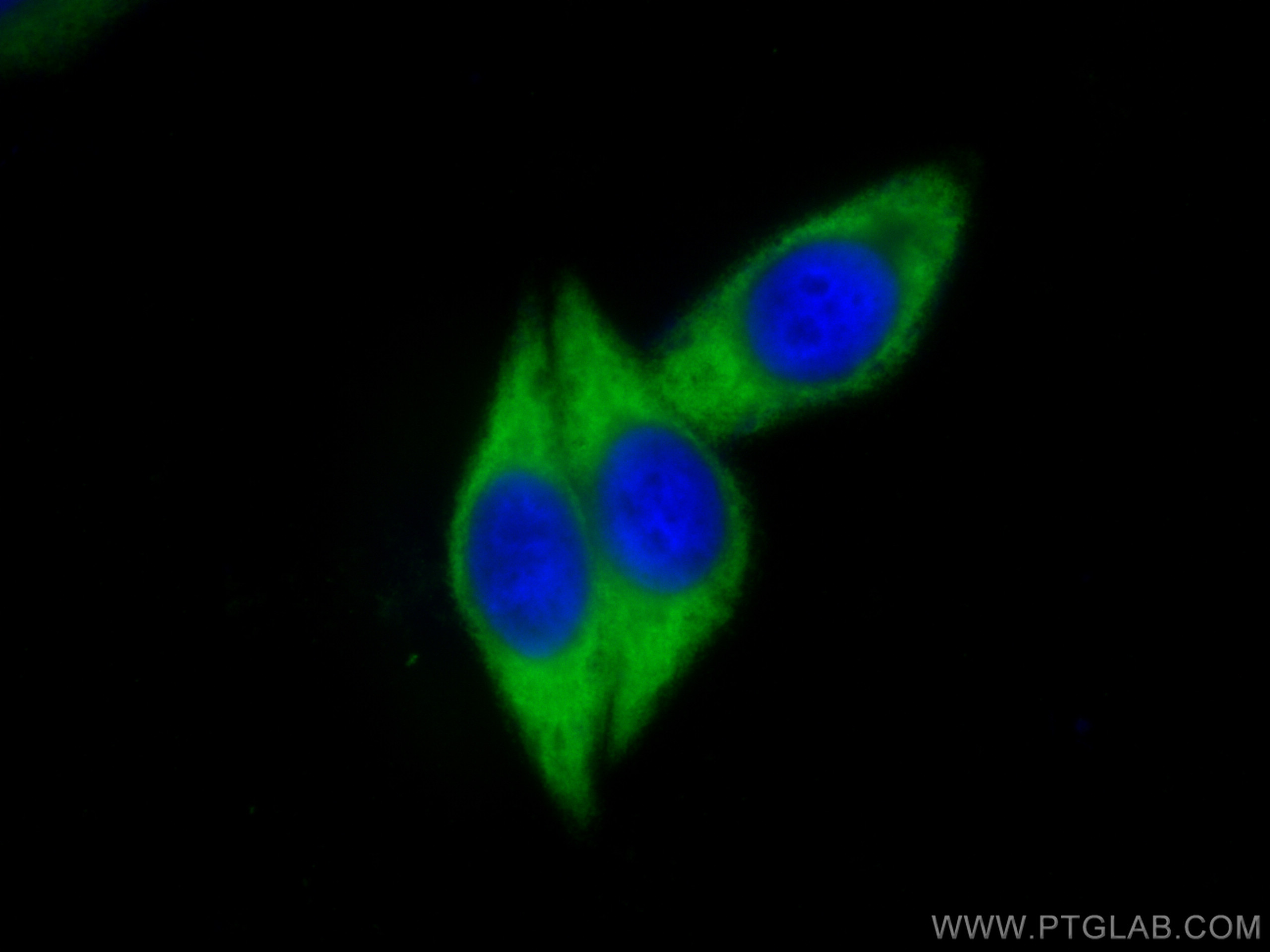 IF Staining of HepG2 using 10227-1-AP