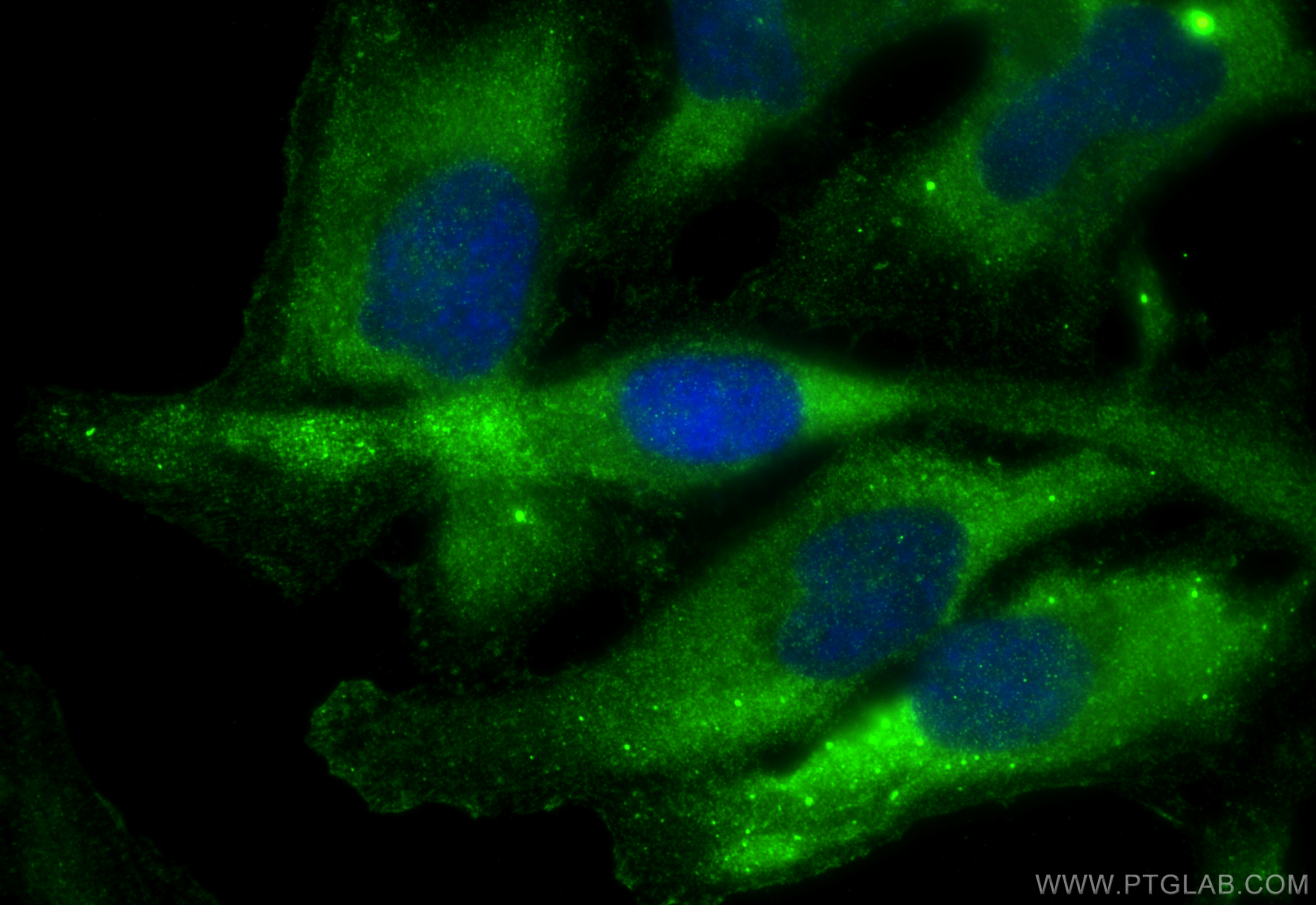 IF Staining of HeLa using 11162-1-AP