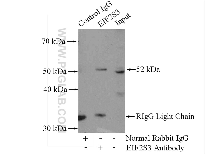 IP experiment of HeLa using 11162-1-AP