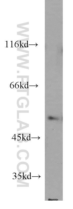 WB analysis of HeLa using 11162-1-AP