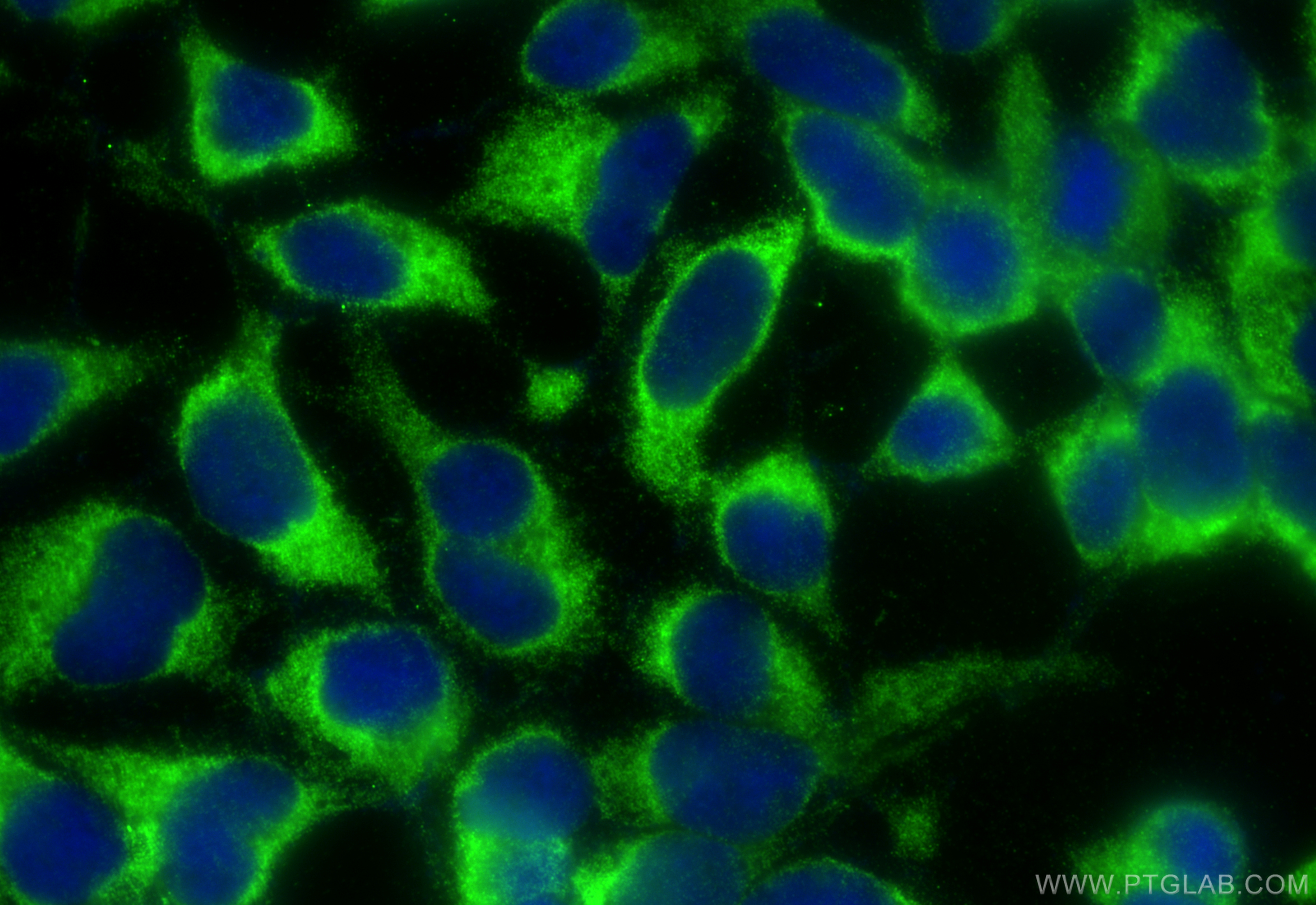 IF Staining of HEK-293 using 26178-1-AP