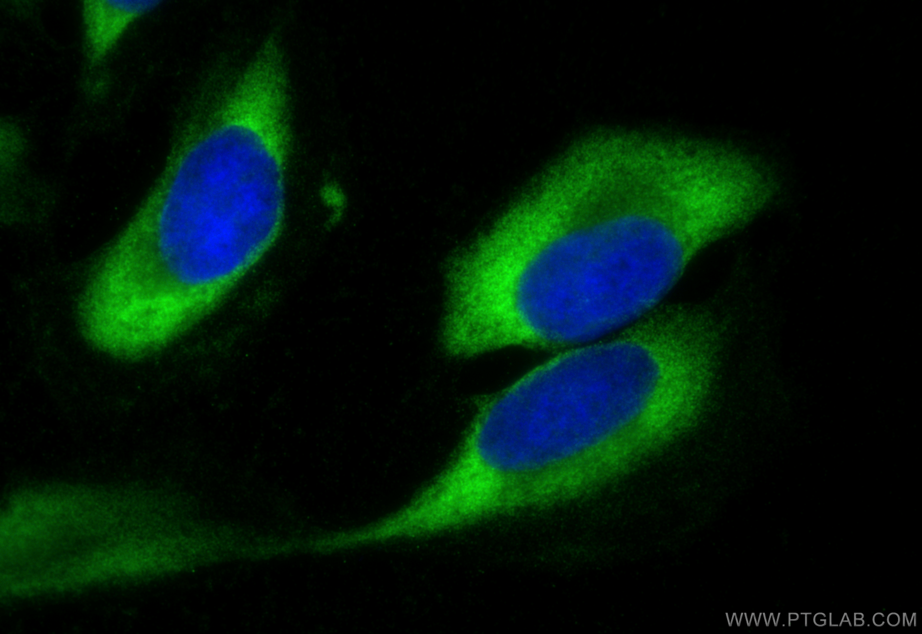 IF Staining of U2OS using 82512-1-RR (same clone as 82512-1-PBS)