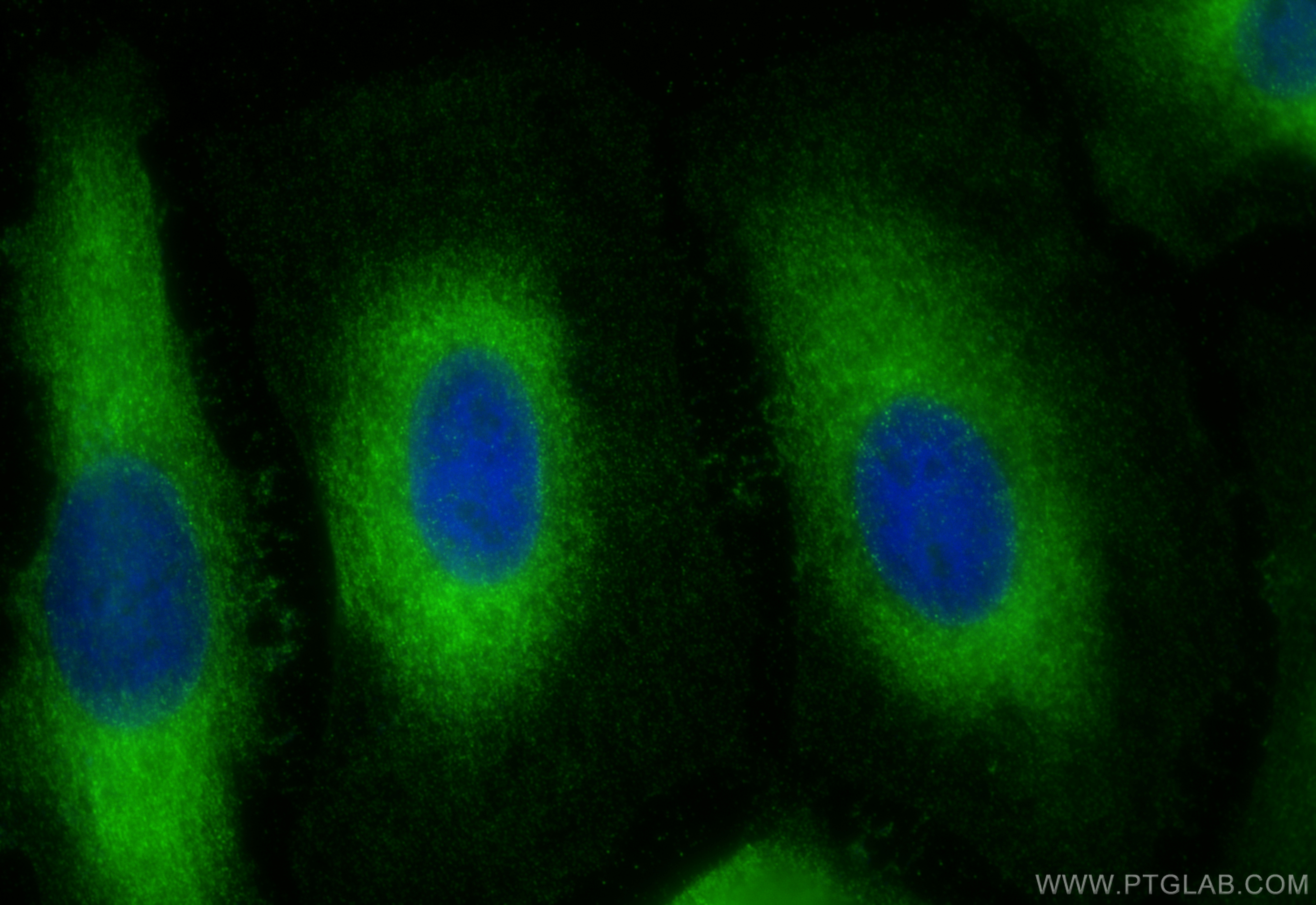 IF Staining of HeLa using 11287-1-AP