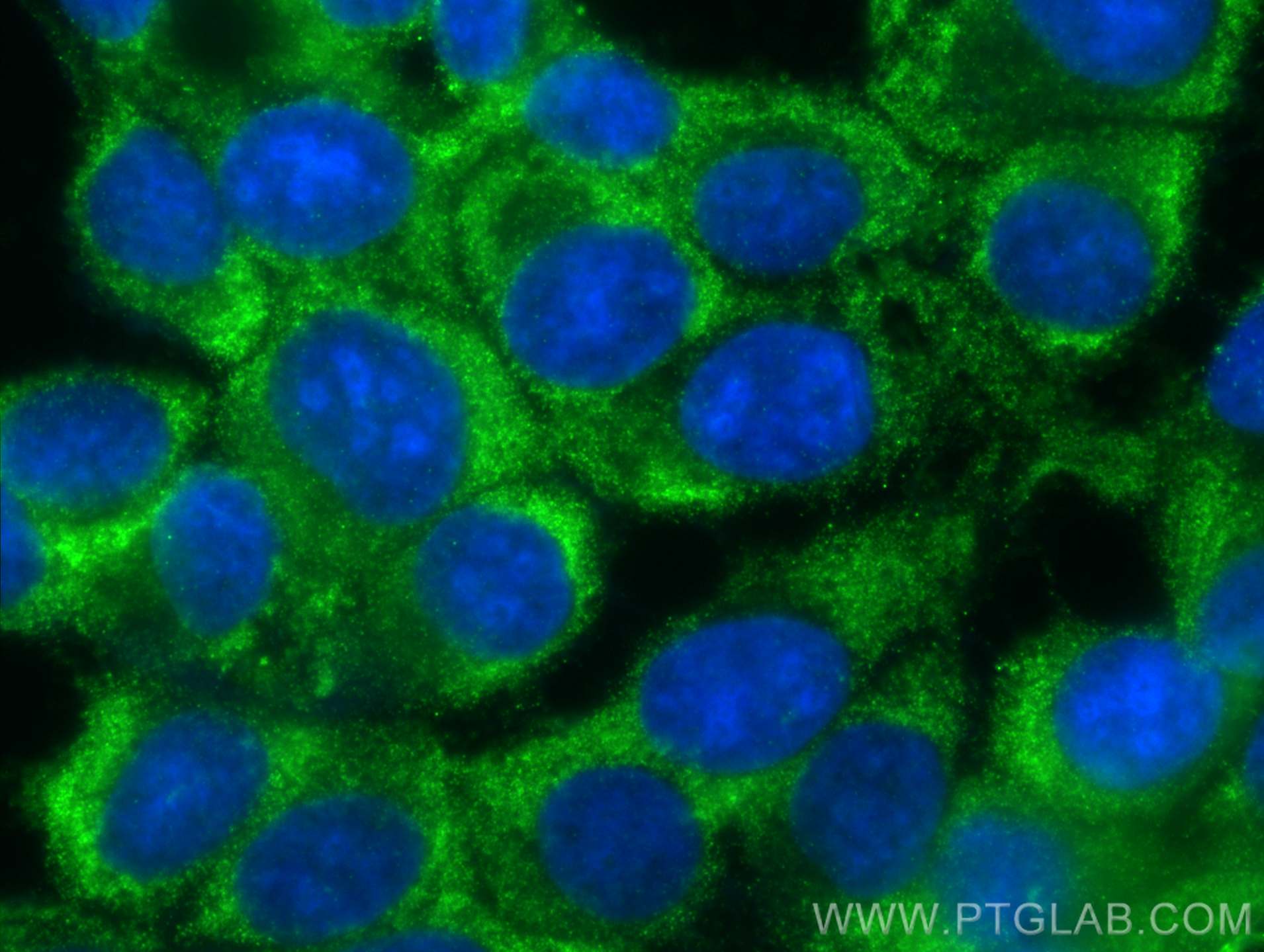 IF Staining of MCF-7 using 66025-1-Ig (same clone as 66025-1-PBS)