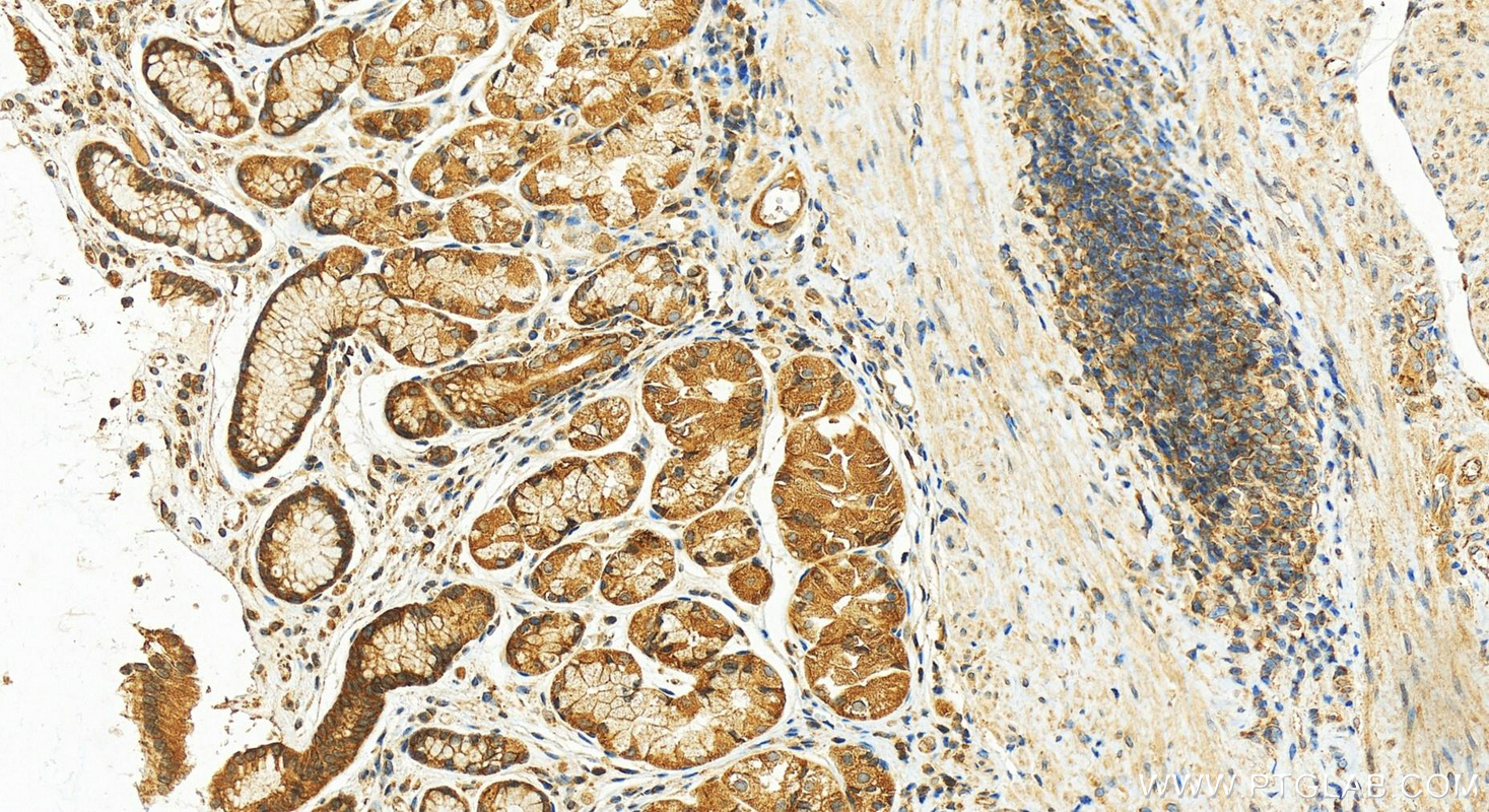 IHC staining of human stomach using 17917-1-AP