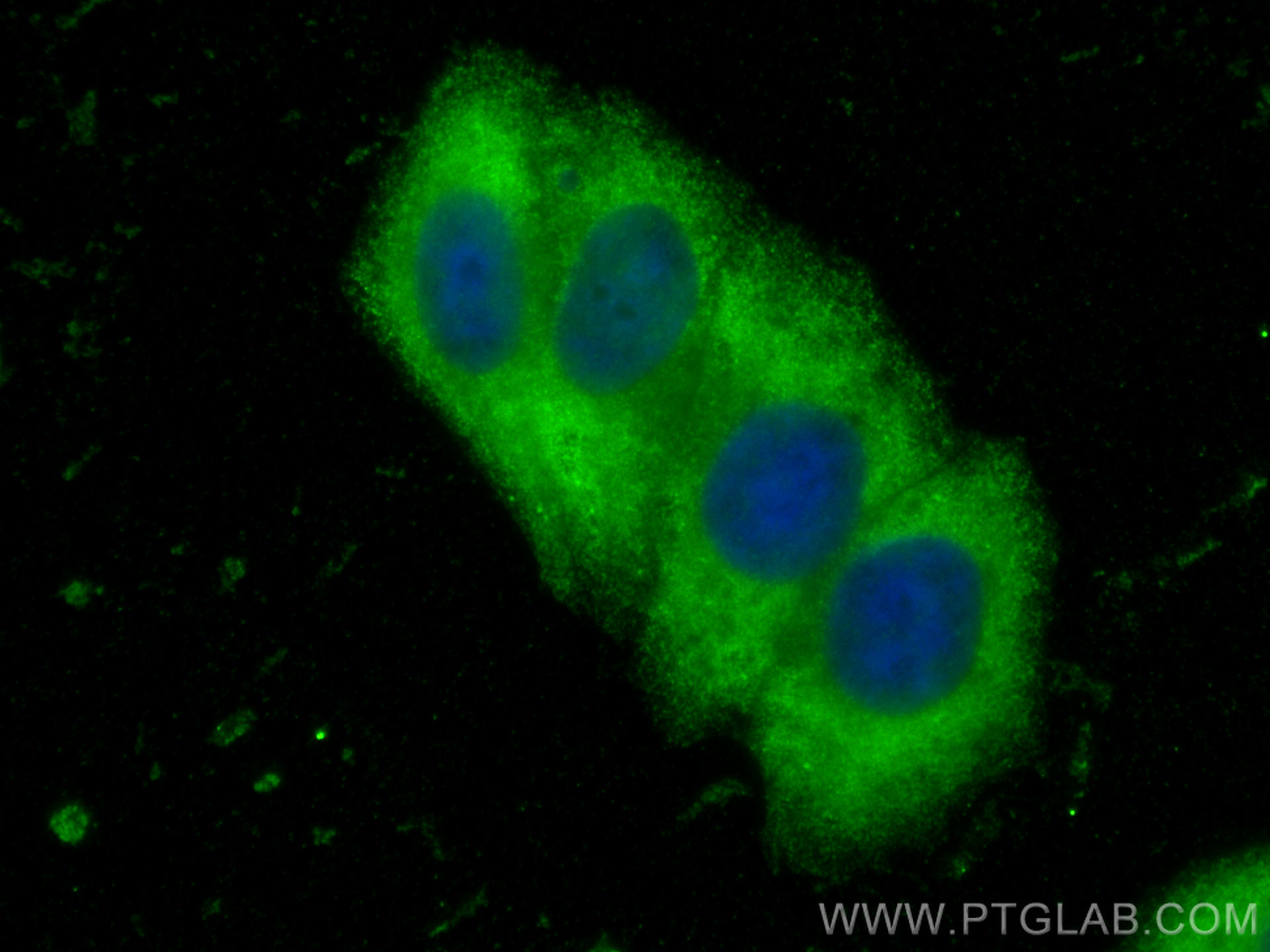 IF Staining of HepG2 using 66655-1-Ig