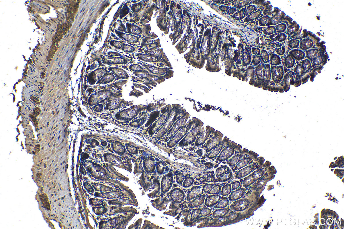 IHC staining of mouse colon using 68171-1-Ig (same clone as 68171-1-PBS)
